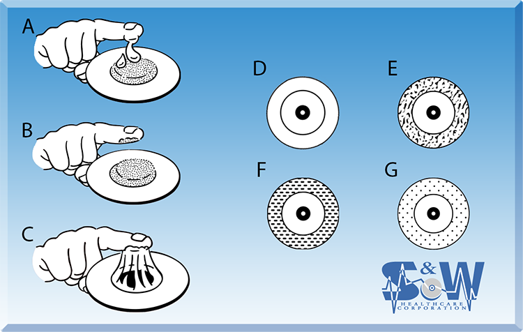 Electrode Gels & Backing Diagrams